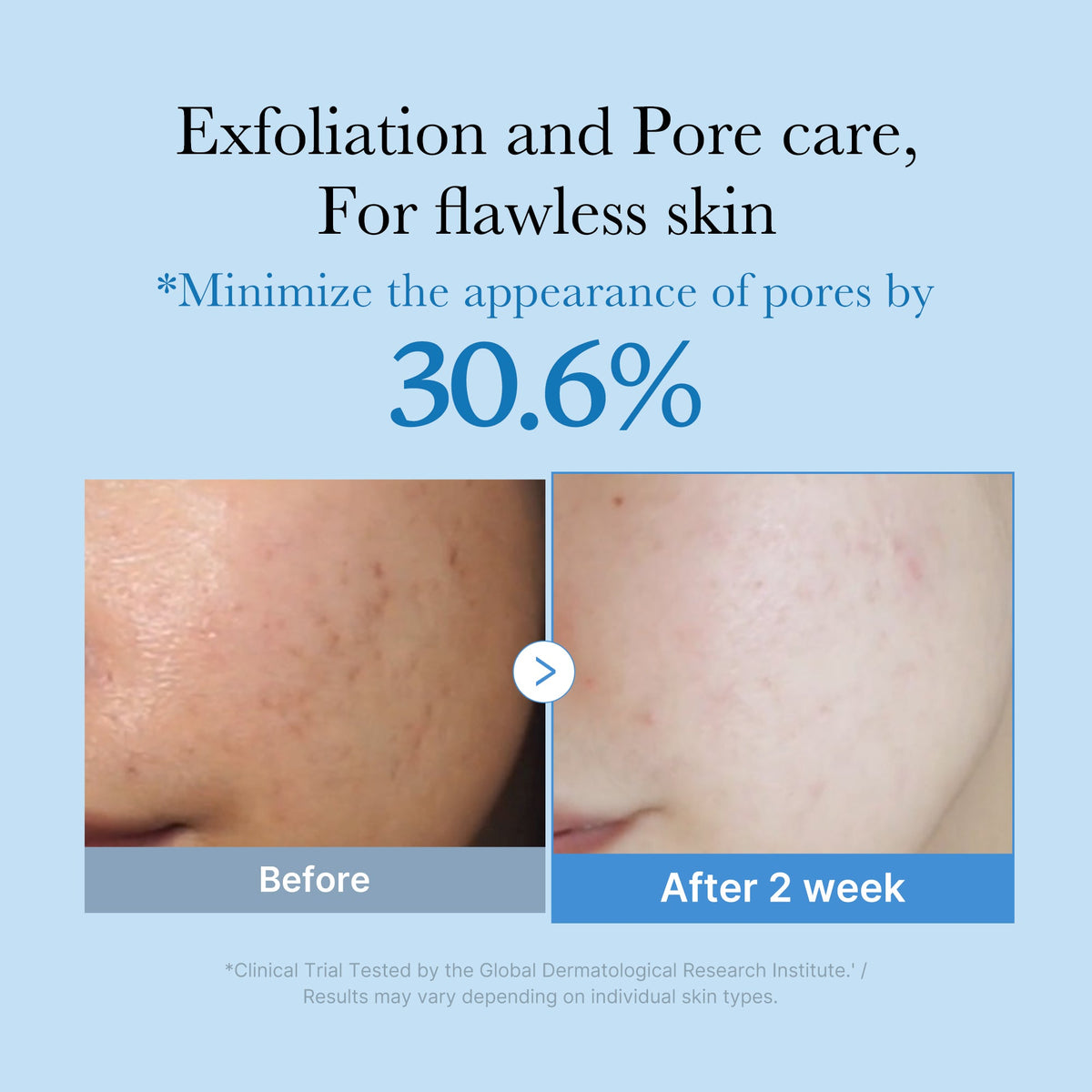 zero-pore-toner-s8 01_d6480b4e-3c08-4954-994a-ed5212c1839c.jpg