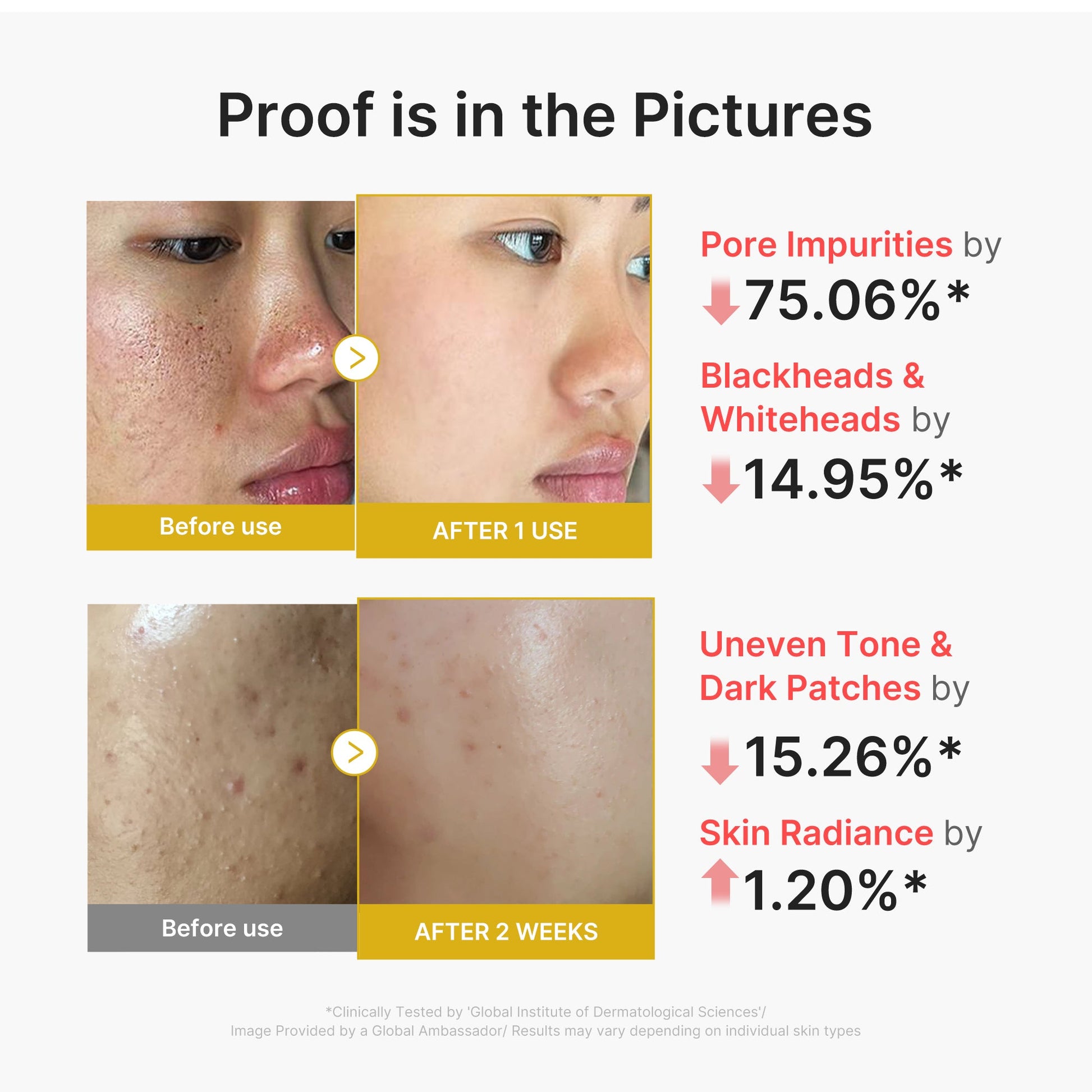 kojic-acid-turmeric-peel-shot-s9 02_45fe66d3-b3f6-4100-aa52-2afd7eded417.jpg