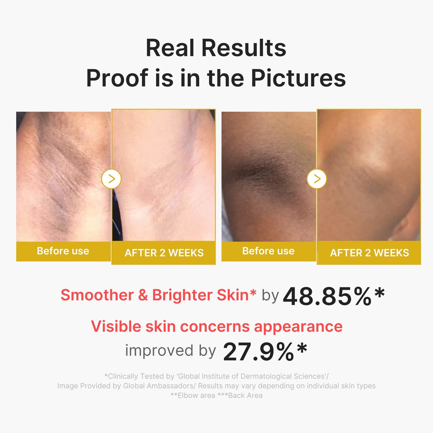 kojic-acid-turmeric-body-peel-shot-i8 02_72880cfc-382b-440b-8152-7e3dce87da2a.jpg