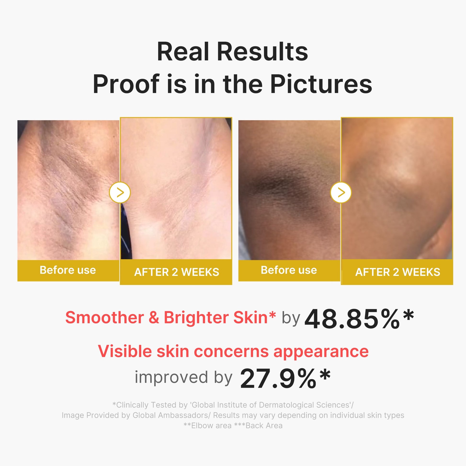 kojic-acid-turmeric-body-peel-shot-i8 02_72880cfc-382b-440b-8152-7e3dce87da2a.jpg