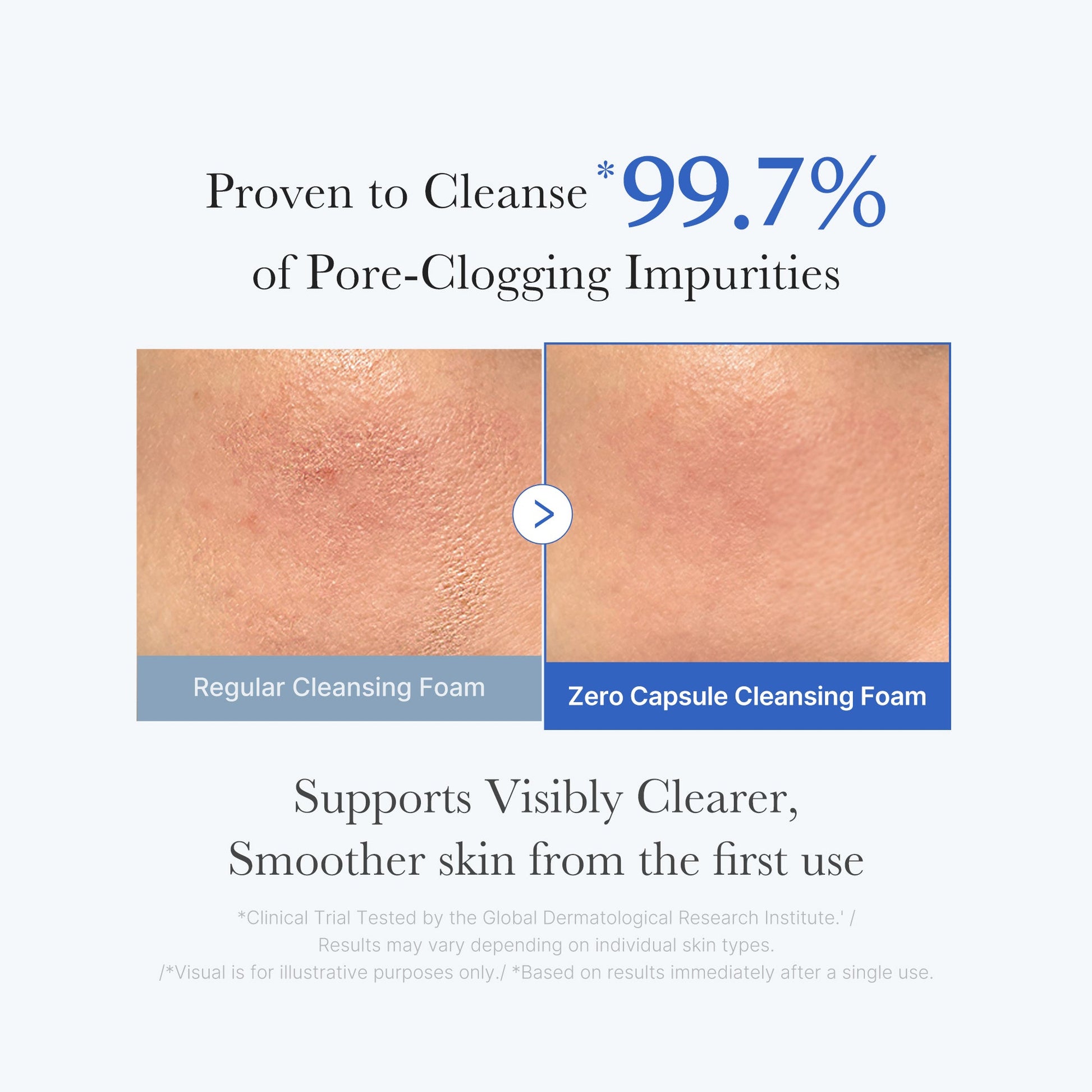 zero-pore-capsule-cleansing-foam-y7 02_c1fb9dfb-86c5-4038-8ff8-490d1006276c.jpg