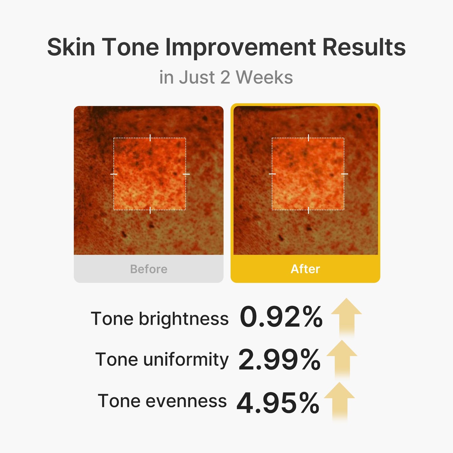 kojic-acid-turmeric-vita-capsule-cream-y6 03_2b626701-fc6c-4702-9e96-a2157a4f7f9d.jpg