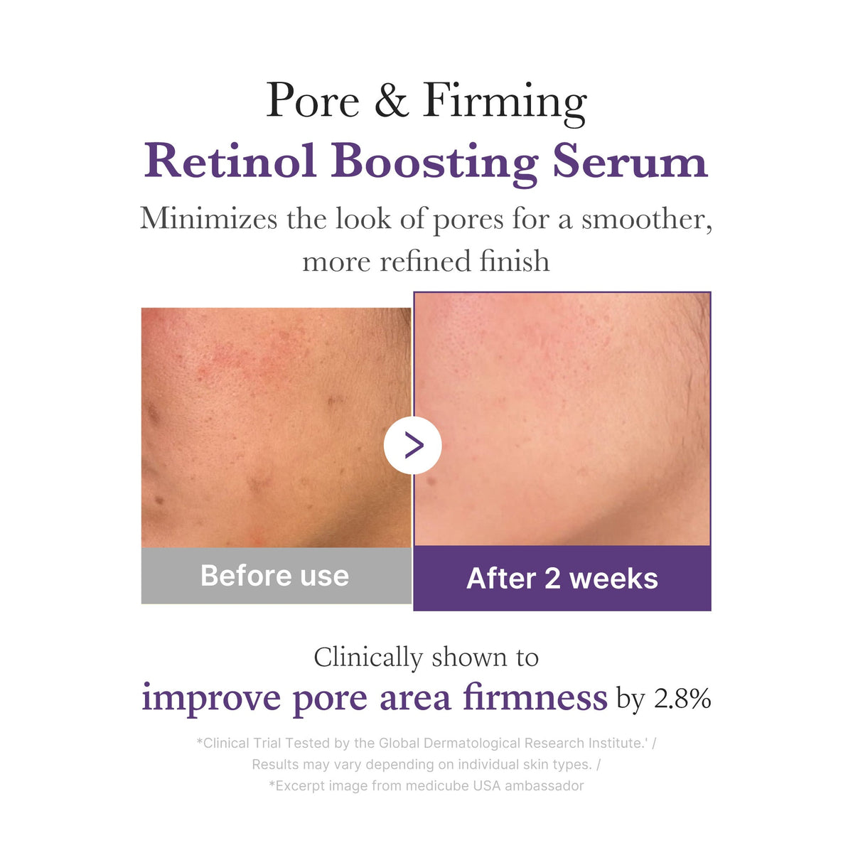 retinol-nmn-boosting-serum-h9 03_3510e7a5-5633-4a18-81ea-1389593bd517.jpg