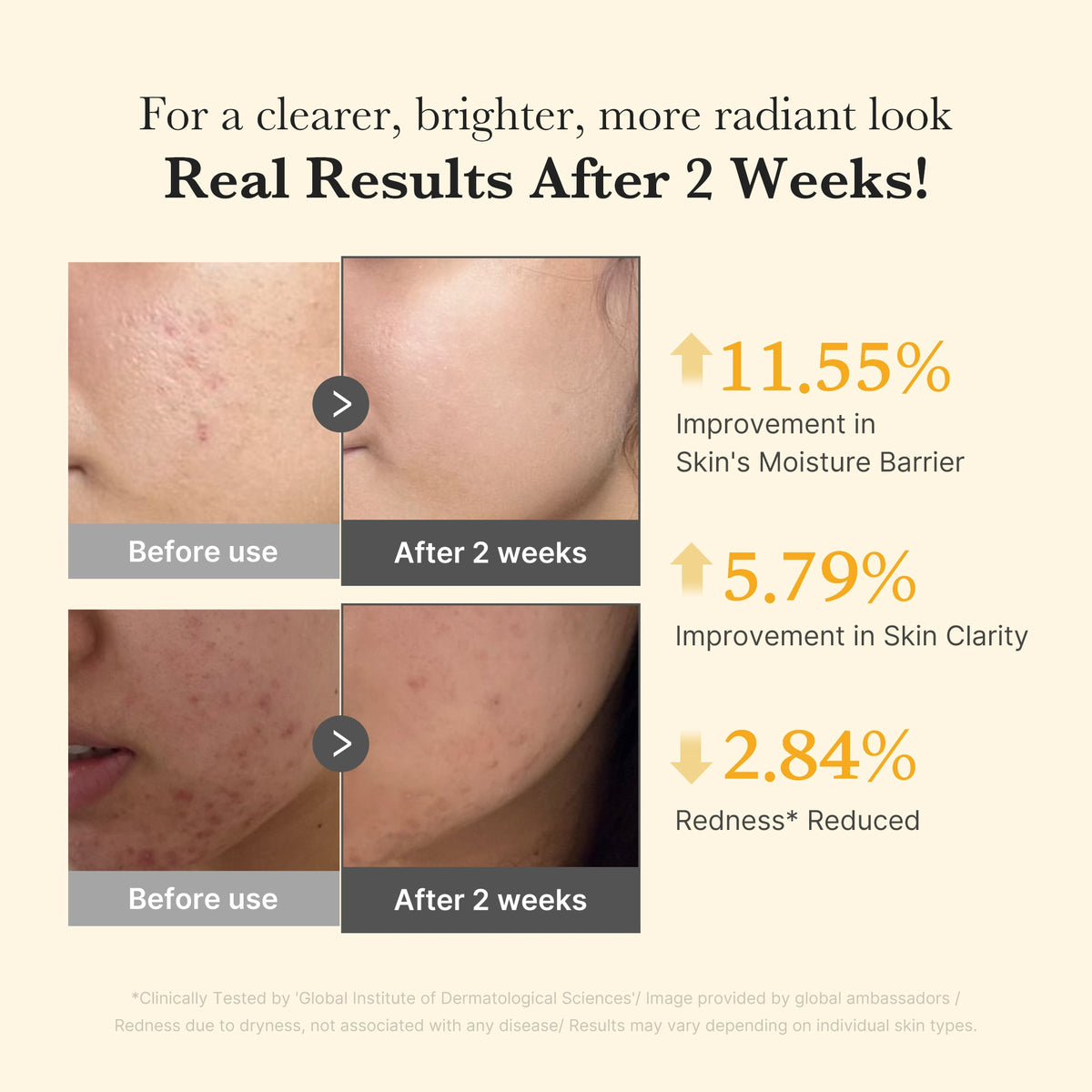kojic-acid-turmeric-capsule-serum-c2 03_436487f5-76df-490e-8a61-01118373efbd.jpg