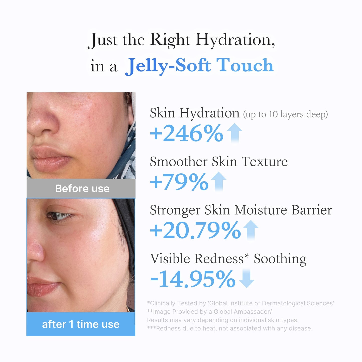 hyaluronic-ceramide-moisturizing-jelly-cream-g1 03_c39d66cc-0839-4e48-ab4a-d32143d06b1c.jpg