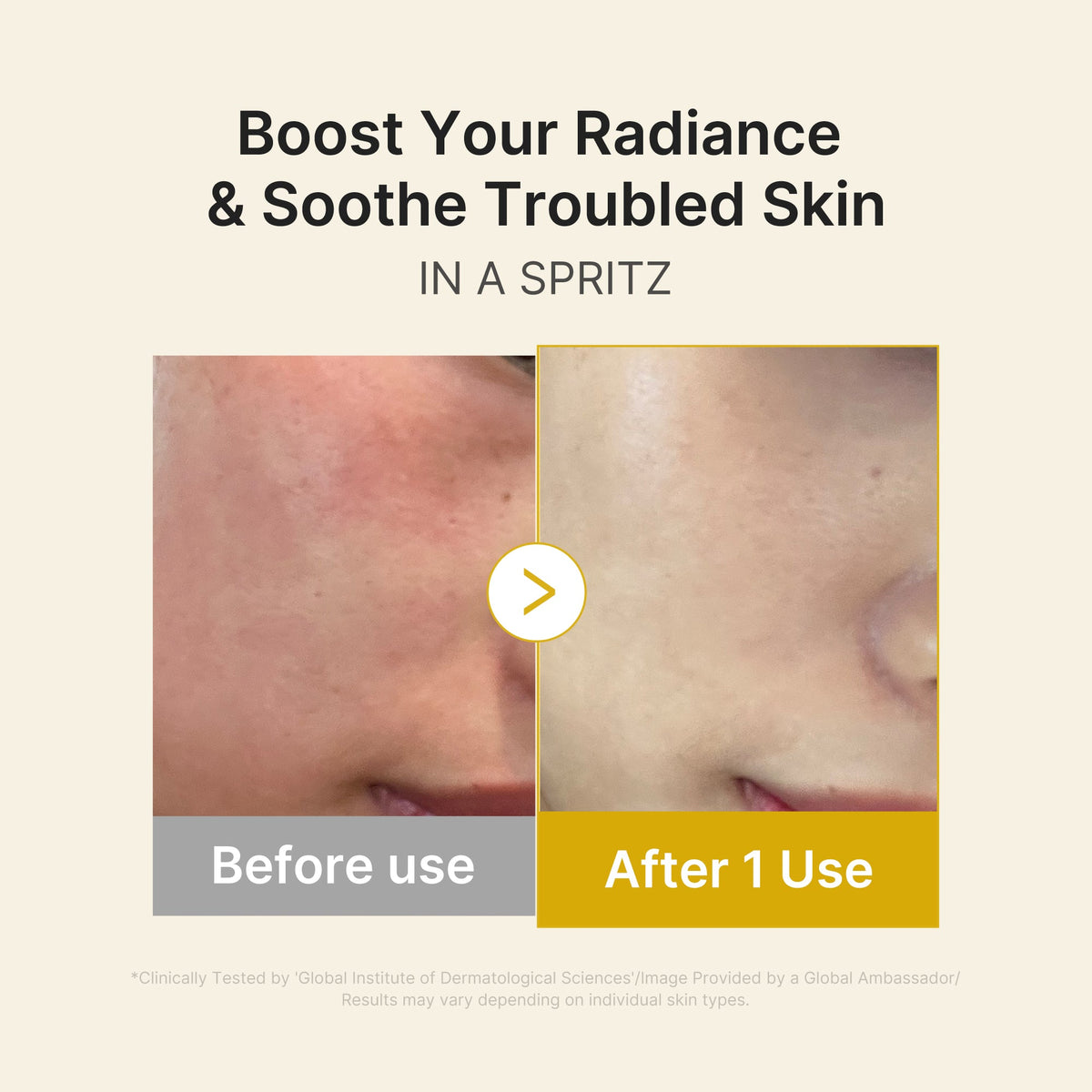 kojic-acid-turmeric-vitamin-gold-jelly-mist-serum-o7 03_dc9cd19e-4e57-49d3-9b66-c7762e8a63f1.jpg