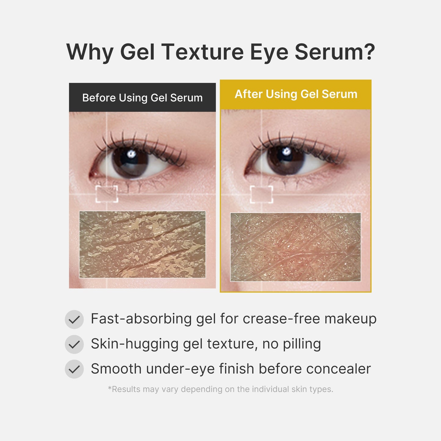 kojic-acid-tumeric-eye-gel-serum-z5 04_0487ef36-49f4-4294-8049-bb55118b05fe.jpg