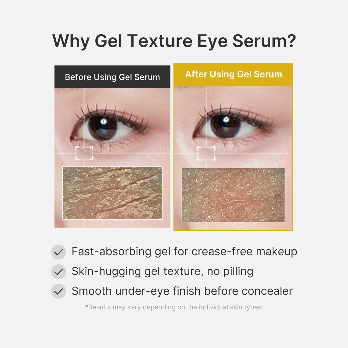 kojic-acid-tumeric-eye-gel-serum-z5 04_0487ef36-49f4-4294-8049-bb55118b05fe.jpg