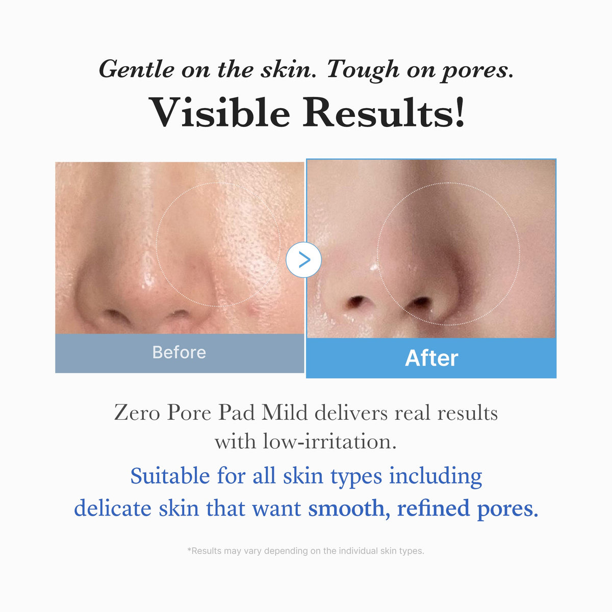 zero-pore-madecassoside-pads-mild-p6 04_6357f9f9-483b-4891-82c6-a58d336e62c8.jpg