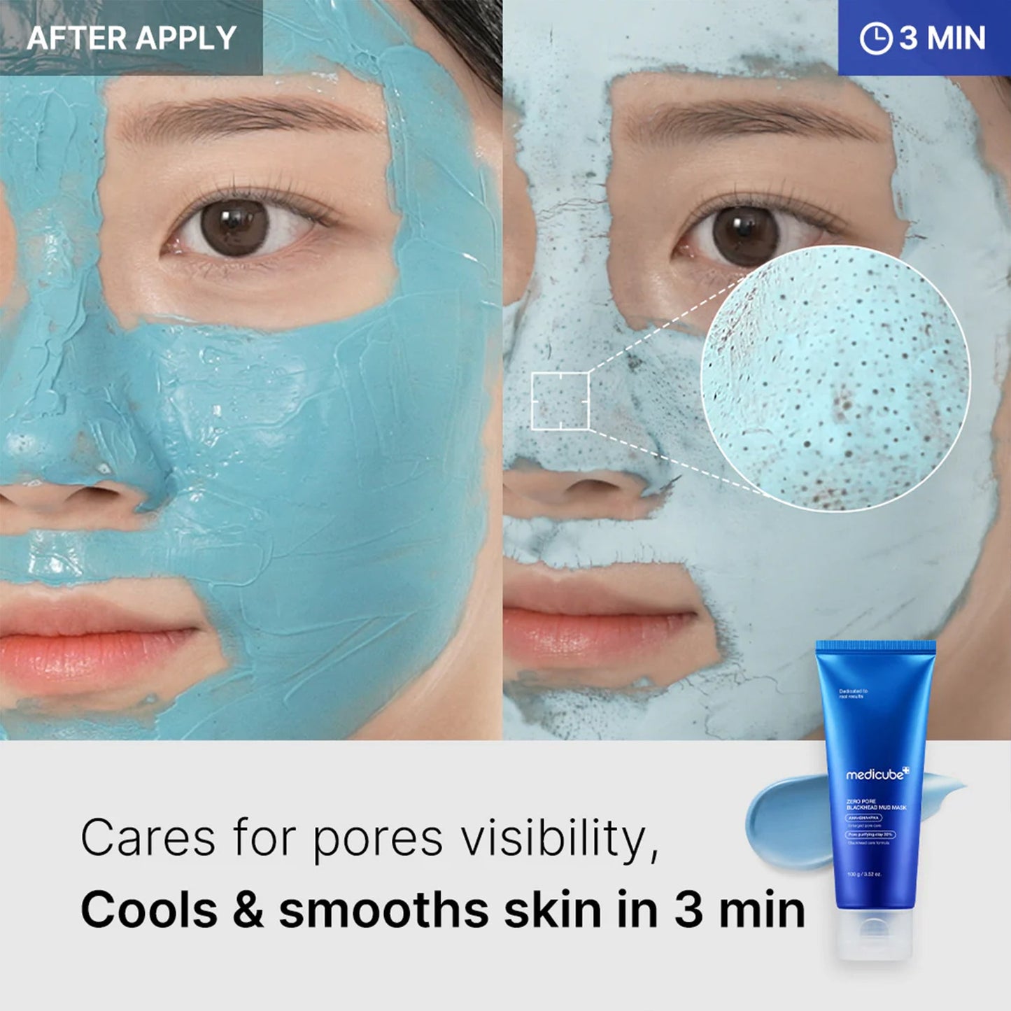 zero-pore-blackhead-mud-mask-q3 04_867c0459-a94e-40d3-bd9a-70400edabe8d.jpg