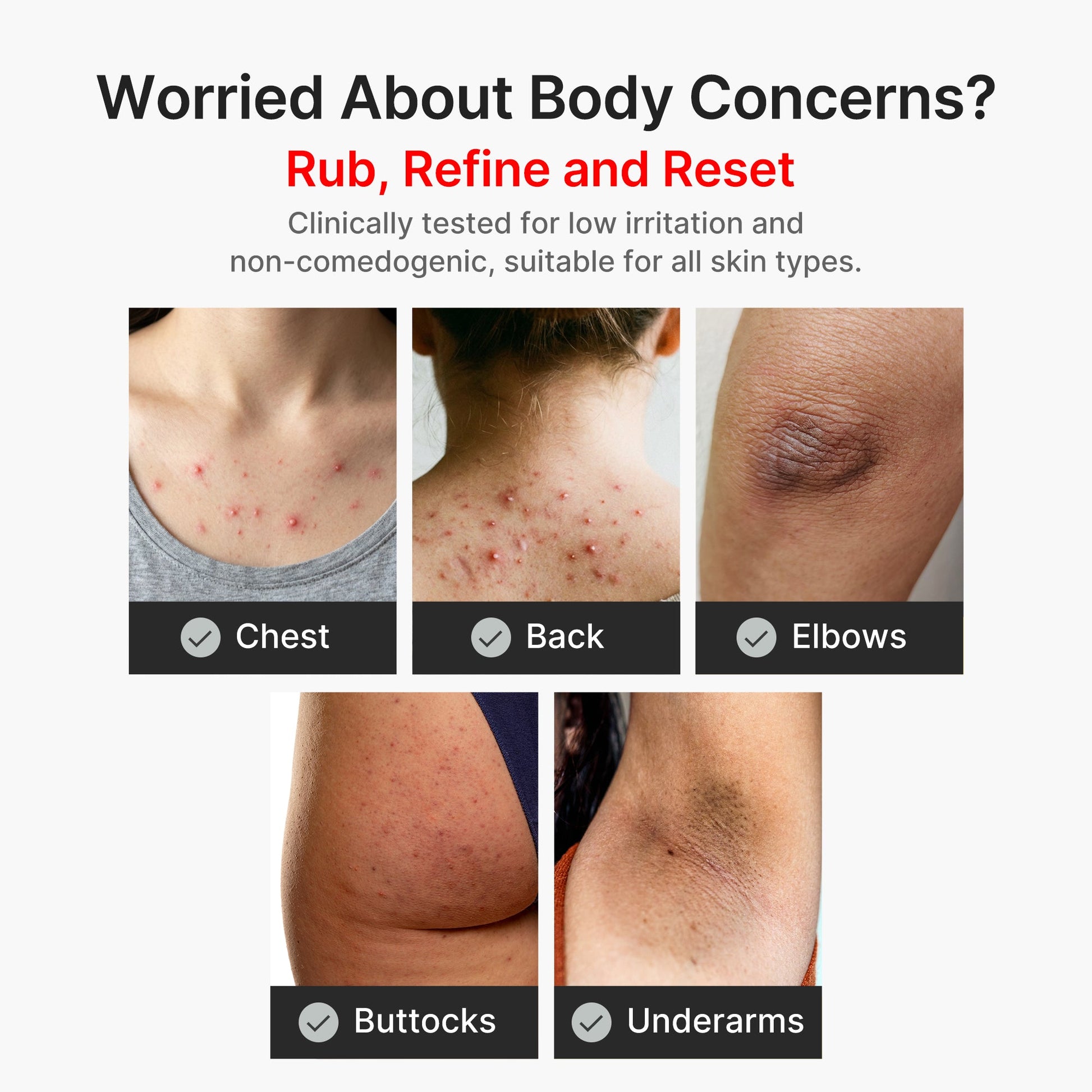 kojic-acid-turmeric-body-peel-shot-i8 04_8a7237f2-3ebf-401e-bd85-54841aeb3efc.jpg