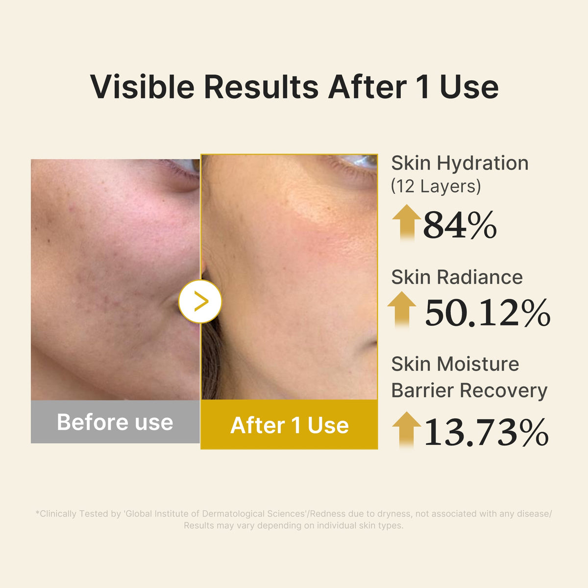 kojic-acid-turmeric-vitamin-gold-jelly-mist-serum-o7 04_d5c55ef1-e03b-494d-bc0d-a1ecc7fc2abf.jpg
