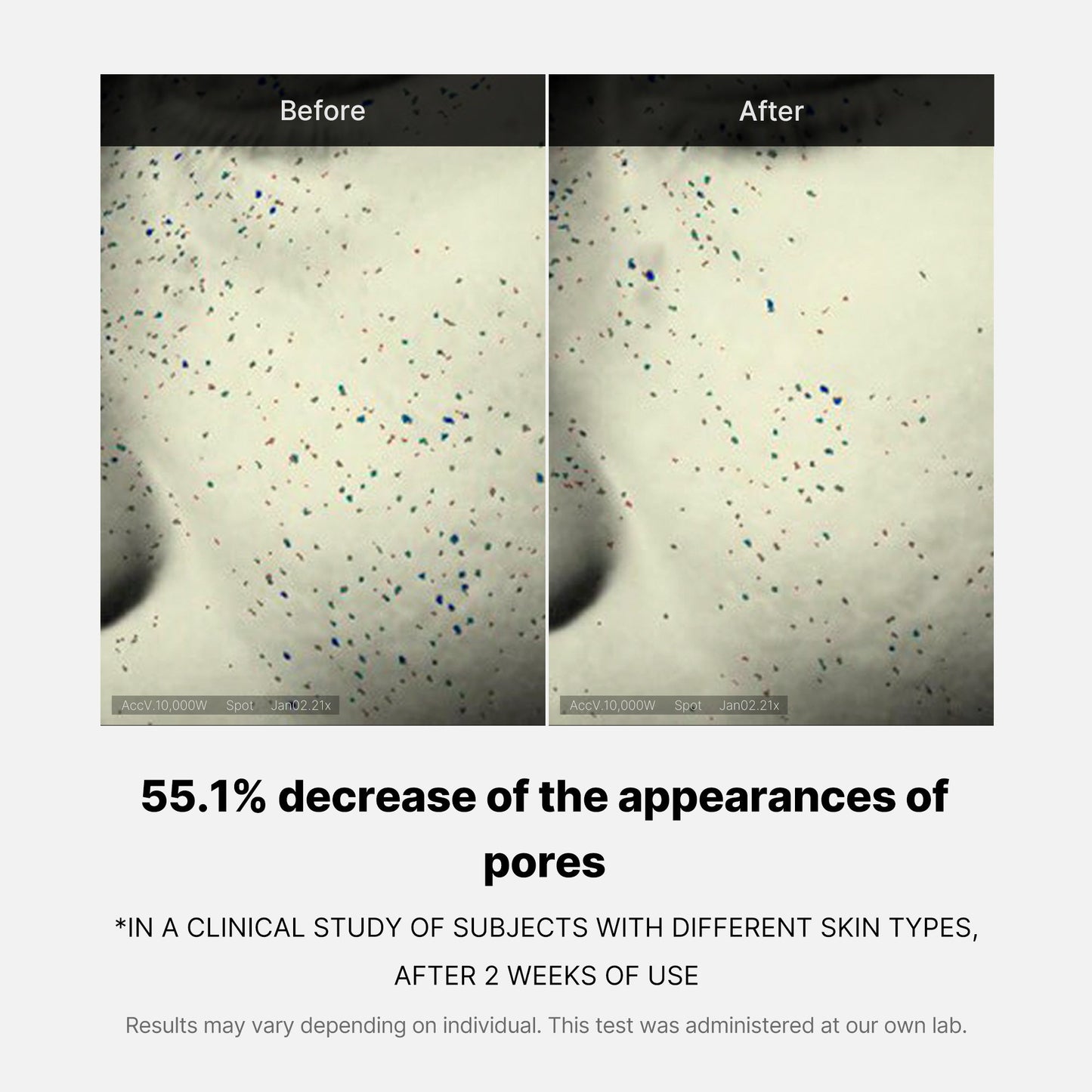 pore-care-duo-t2 05_12ddab8a-64be-4612-8ee1-27e5ec701921.jpg