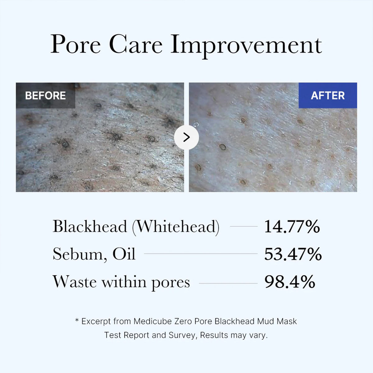 zero-pore-blackhead-mud-mask-q3 05_9362a158-c2b3-4525-acc0-631a2cfdea47.jpg