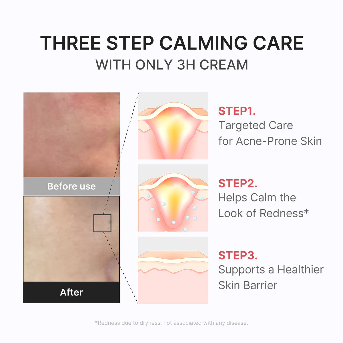3h-daily-relief-cream-k3 3H_04.jpg