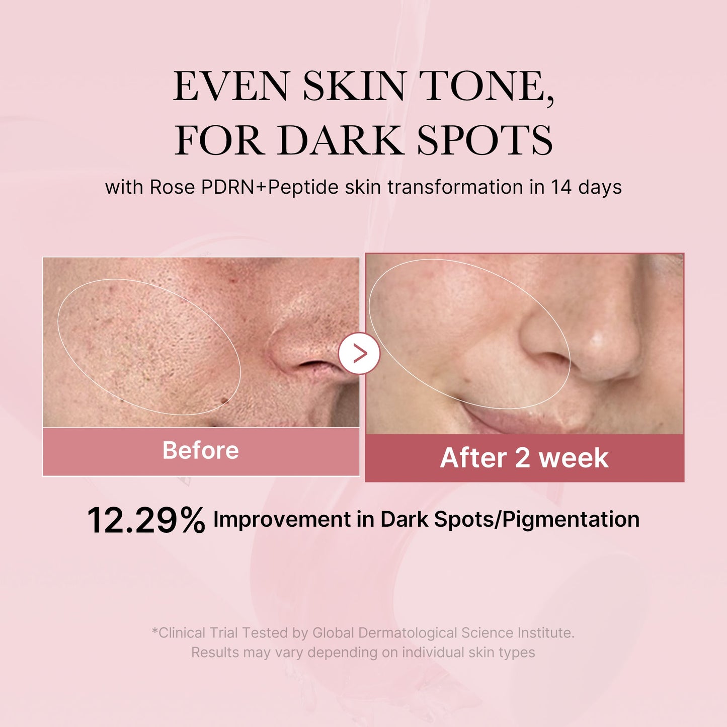 pdrn-pink-peptide-toner-u0 PDRN_01_308c518e-5ac6-4e54-99bd-eabc8796739b.jpg