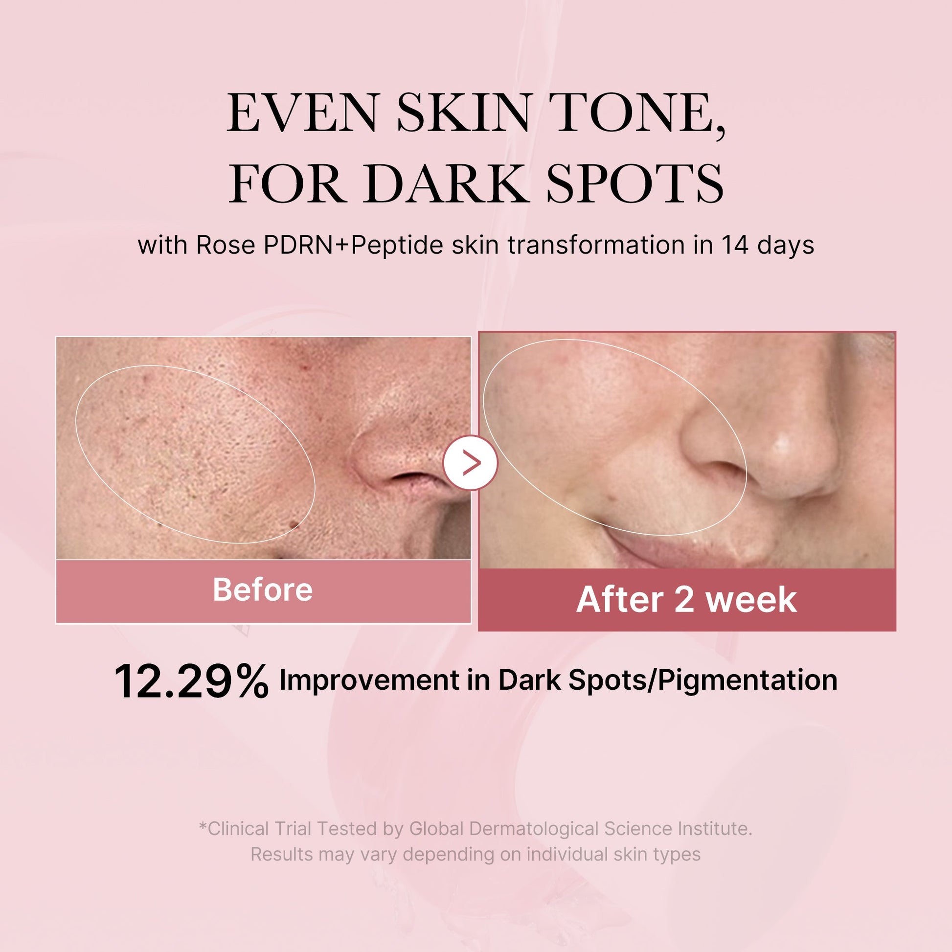pdrn-pink-peptide-toner-u0 PDRN_01_308c518e-5ac6-4e54-99bd-eabc8796739b.jpg