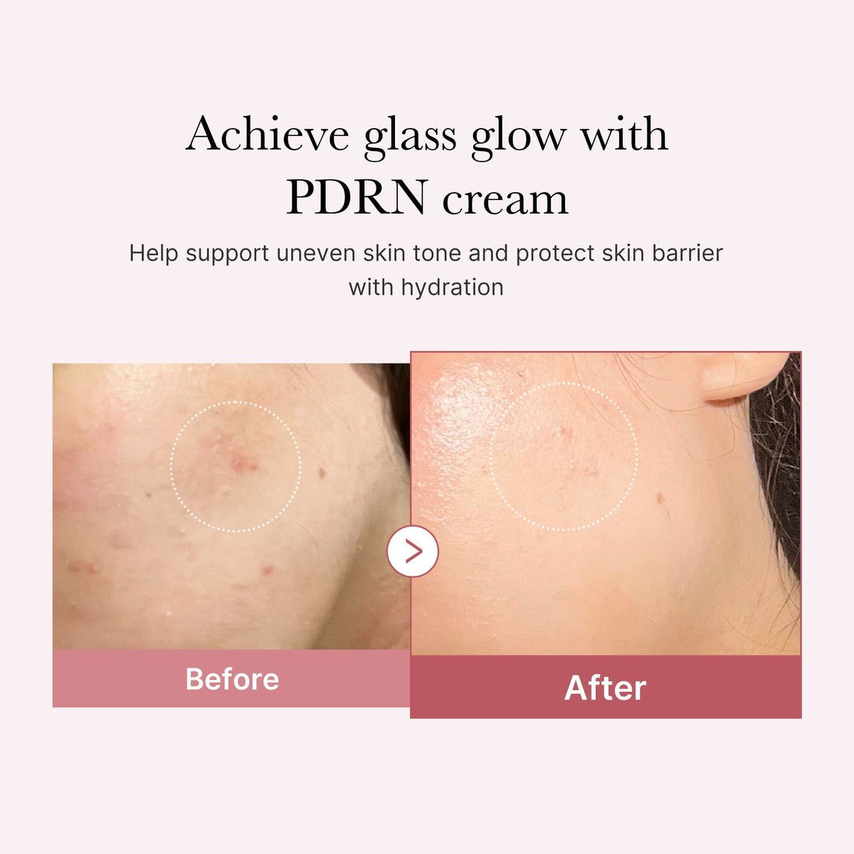 pdrn-pink-peptide-cream-o8 PDRN_02_d7805bfe-cf43-446a-b71b-a276683f136b.jpg