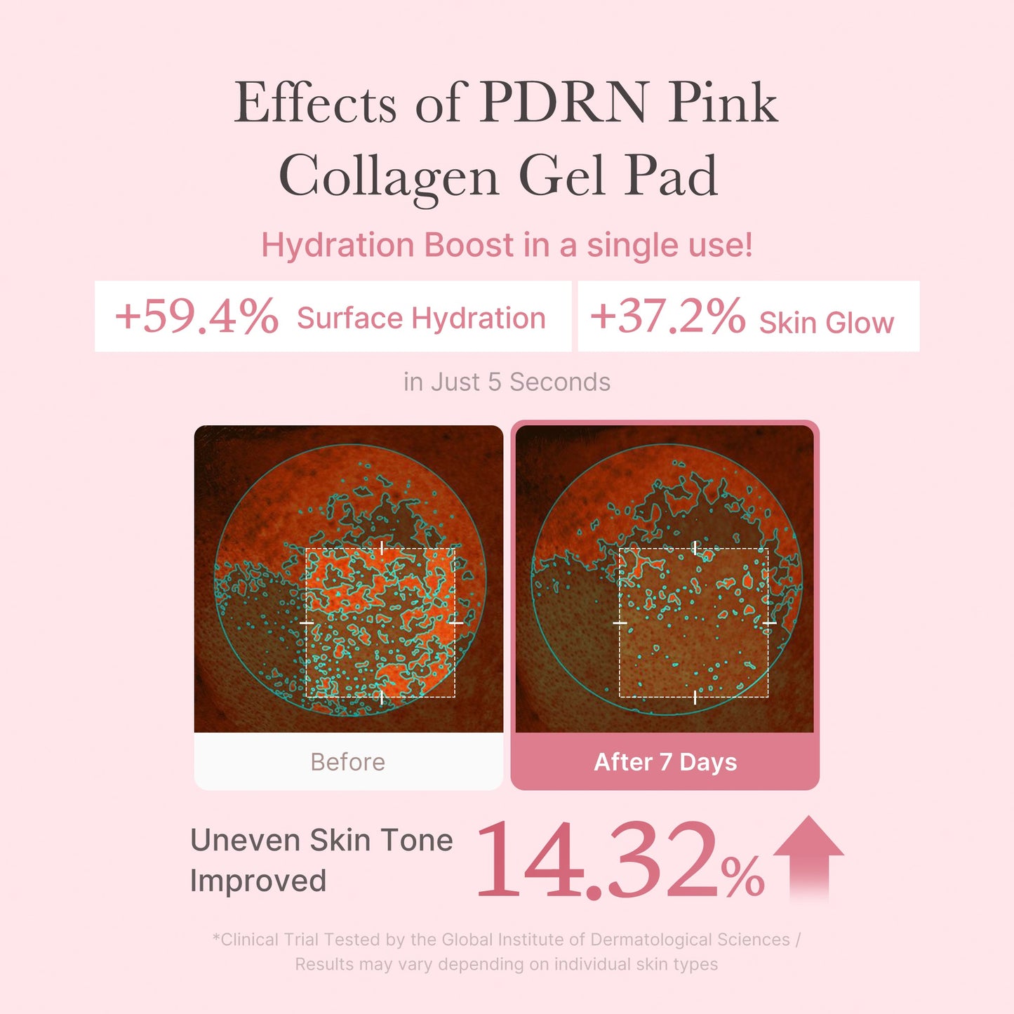pdrn-pink-collagen-gel-toner-pad-r8 PDRN_04_f9a16a56-8d9e-4c47-a635-ed34ec3ed571.jpg