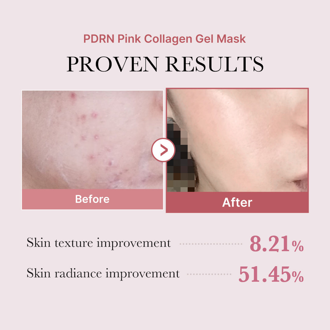 salmon-pdrn-pink-collagen-jelly-gel-mask-q7 PDRN_12.jpg